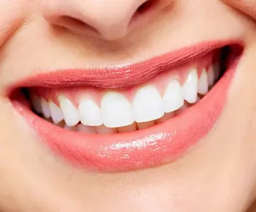 Ilustração de clareamento dental