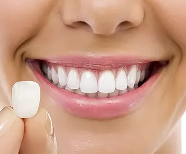 Ilustração de lentes de contato dental